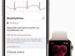Apple iPhone watch ecg de screen 03272019