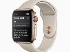 Apple watch ecg result es es screen 03272019